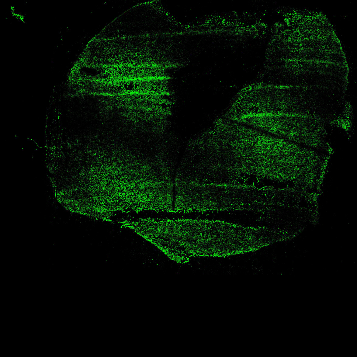 Human foetal midbrain